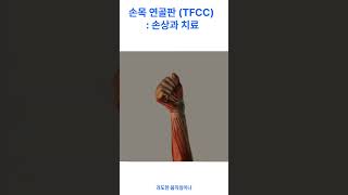 손목 연골판 삼각 연골 윤상체 TFCC  손상과 치료 [upl. by Durkin]