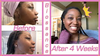 Biossance Skincare Review  Before  After 1 Month [upl. by Leinoto817]