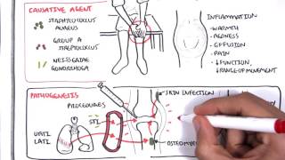 Septic Arthritis  Overview causes pathophysiology treatment [upl. by Otineb]