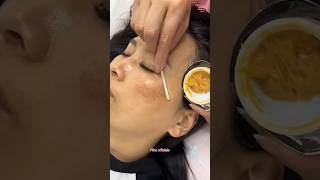 Remove Dark Spots amp Pigmentation Naturally At Home  Get Glowing Skin skin beautiful shorts [upl. by Truitt]