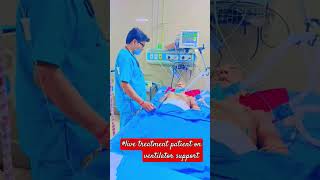 live treat patients on ventilator support ajeetsingh medical ki duniya short [upl. by Nerot]