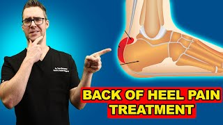 Retrocalcaneal Heel Bursitis Pain in the back of the Heel TREATMENT [upl. by Araed272]