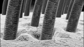 hair under microscope human hair under microscope [upl. by Lehcyar660]