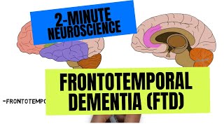 2Minute Neuroscience Frontotemporal Dementia FTD [upl. by Siesser]