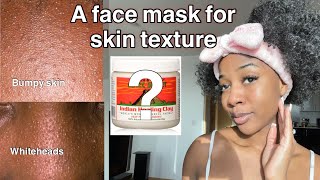 How to use Aztec healing clay to remove bumpy skin texture‼️ [upl. by Buna438]