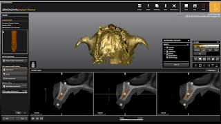 Zirkonzahn  Implant Planner [upl. by Calv]