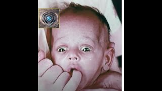 Neurological Examination of the Newborn 1960  Great medical history all medical students should see [upl. by Caril]