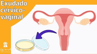 Cultivo cérvico  vaginal TOMA DE MUESTRA y patógenos [upl. by Bordiuk]