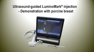 Sonoguided Injection of LuminoMark  Ultrasound pattern of injected LuminoMark [upl. by Ahselrak]