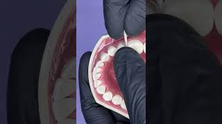 Class II cavity preparation tips and tricks Protecting the adjacent dentist dentistry [upl. by Frierson]