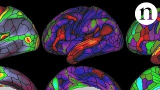 The ultimate brain map [upl. by Giulietta]