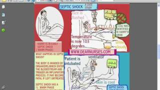 SESSIONS for NURSES 10  CARDIOGENIC AND SEPTIC SHOCK [upl. by Ahsotan]