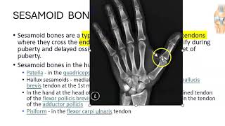 Anatomy 201 Sesamoid Bone Patella Pisiform Carpal bones Define Solved Question Paper [upl. by Cavanagh]