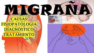 MIGRAÑA CAUSAS SÍNTOMAS FISIOPATOLOGÍA DIAGNÓSTICO Y TRATAMIENTO [upl. by Ney]