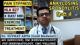 Ankylosing Spondylitis in Hindi by Dr Suvrat Arya Rheumatologist MD DM Rheumatology Delhi NCR [upl. by Weinhardt]