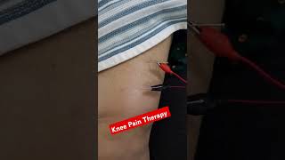 Dry Needle Therapy for knee painReduce knee PainNeedle TherapyRelief knee Pain TreatmentDrAnup [upl. by Charleton]