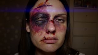 Severe Swollen Black Eye amp Bruise SFX Halloween Makeup 2019 SMASHINBEAUTY [upl. by Remoh]