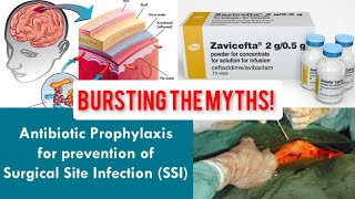 Bursting the myths 3Antimicrobial MythsAcute MeningitisCeftazidime avibactamSurgical Prophylaxis [upl. by Quintana982]