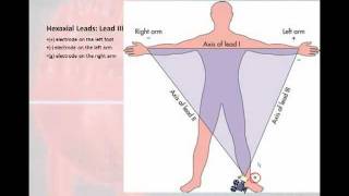 12 Lead Interpretation Part 1 Introduction to the 12 Lead EKG [upl. by Yrokcaz]