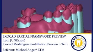 EXOCAD TUTORIAL 2016Exocad Modellgussmodellation Preview 2 Teil 1 PARTIAL FRAMEWORK [upl. by Ecinreb]