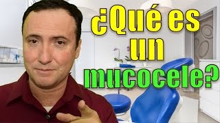 ¿Qué es un mucocele [upl. by Mohun]