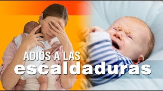 Las escaldaduras en los bebés  síntomas causas y soluciones [upl. by Bernard]