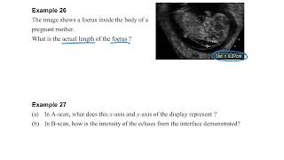 Medical Physics Part 230 Example 2629 [upl. by Keheley]