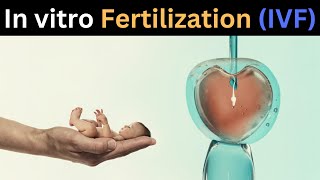 What is In vitro fertilization   how test tube babies are produced  3d animation [upl. by Melborn]