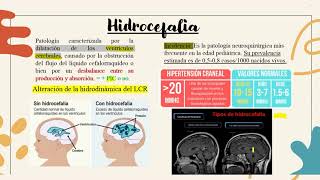 Todo lo que debes saber sobre hidrocefalia [upl. by Windsor290]