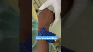 Cannula insertion of female patient cannulationcannula nurses doctorneetmbbsaiims shorts [upl. by Pavla]