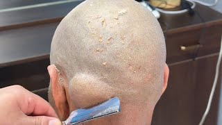 💈ASMR  Top master remove hair and dead skin from elders head for free 🪒 Insane shaving skills [upl. by Obau]