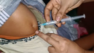 IM Intramuscular Arm injection Push Hydrocortisone  Cotson  injection 24 Ep 99 Anik Health Tips [upl. by Annayak]