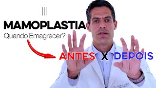 Mamoplastia preciso emagrecer antes ou depois da minha cirurgia plástica [upl. by Stannfield]