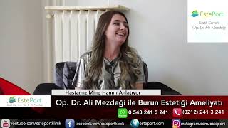 Burun Estetiği Olan Hastaların Yorumları [upl. by Donell]