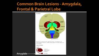 Common Brain Lesions  Amygdala Frontal amp Parietral Lobe [upl. by Abrahamsen675]