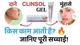 दाने और मुंहासे के लिए। Clinsol Gel review in hindi  clinsol benefitsside effects  clinsol gel [upl. by Karoline]