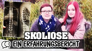 SKOLIOSE 🚑 Diagnose Behandlung amp OPERATION  Erfahrungsbericht [upl. by Revert963]