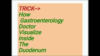 MNEMONICINDICATIONS OF UPPER GI ENDOSCOPY medicinelecturesendoscopy medicaleducation [upl. by Sucitivel]