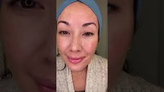 Getting a VI Peel chemical peel for my melasma  shorts [upl. by Kaylee58]