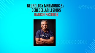 Neurology Mnemonic 6  Cerebellar lesions [upl. by Ansev]