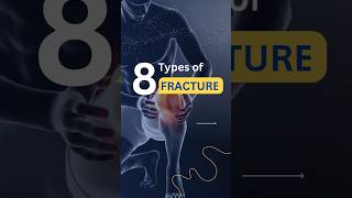 Types of bone fractureMedical Minute bones fracture bonefracture anatomy shorts medical [upl. by Neumeyer365]