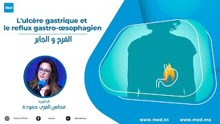 Dr Mahassen Ghozzi Hammouda  Lulcère gastrique et le reflux gastro œsophagien [upl. by Neladgam]