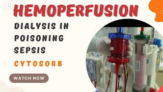 What is Hemoperfusion  Dialysis in Poisoning  Dialysis in sepsis  cytosorb [upl. by Maghutte]