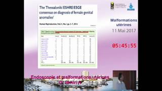 Comment explorer les malformations utérines Dr Ahmed SKHIRI 2017 [upl. by Idolem]