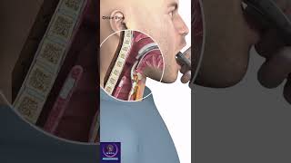 Endotracheal Intubation education shorts [upl. by Haela]