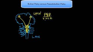 Bulbar Palsy versus Pseudobulbar Palsy [upl. by Presber989]