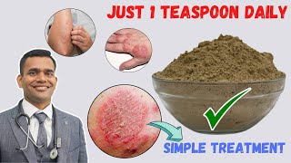 Just 1 Teaspoon Daily To Cure all Your Skin Problems  Eczema  Simple Treatment [upl. by Ytsud]