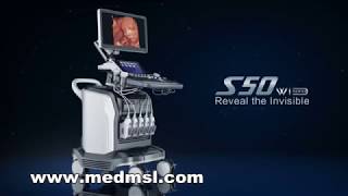 sonoscape S50 4D ultrasound baby scan tech S50 S40 S20 S2 S6 S8 S9 S11 S12 [upl. by Thomson735]