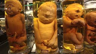 Dead Baby Museum🔴secretly filmed Amsterdam [upl. by Nostaw]