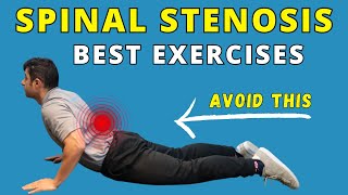 Best Exercises for Spinal Canal Stenosis Pain Relief [upl. by Coonan543]